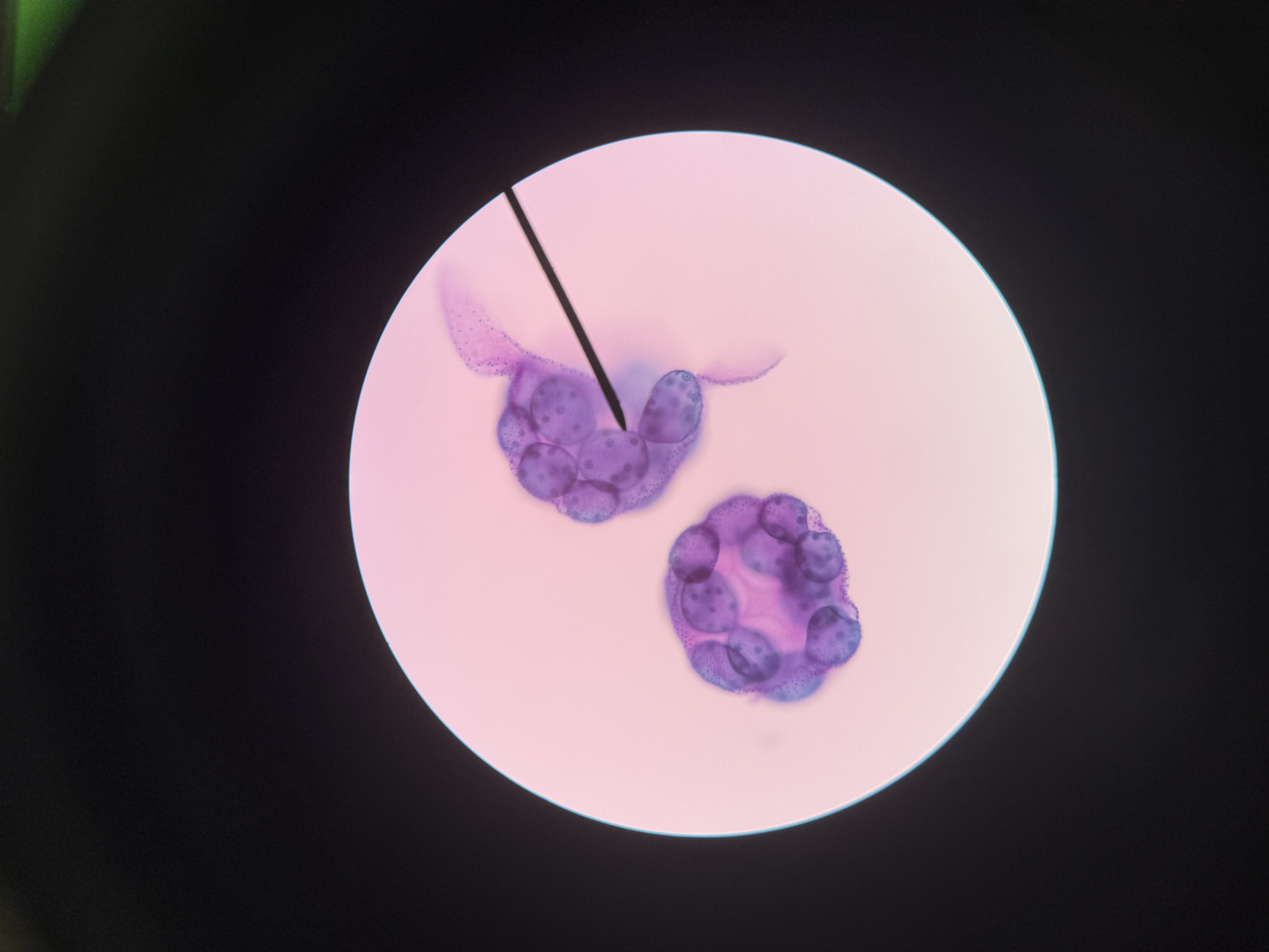 <ol><li><p>What is this?</p></li><li><p>What phylum?</p></li><li><p>Spore location?</p></li><li><p>Autotrophic or heterotrophic?</p></li><li><p>Unicellular or multicellular?</p></li><li><p>What supergroup is it in and where is it found?</p></li><li><p>What is the “wall” of its colony composed of?</p></li><li><p>How many flagella does each cell have?</p></li></ol><p></p>