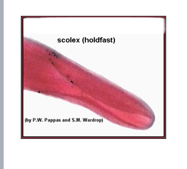 <p>1st intermediate host: A planktonic crustacean</p><p>2nd intermediate host: Freshwater fish</p><p>Definitive Host: Humans (eating fish eating mammals such as bears, wolves, foxes)</p>