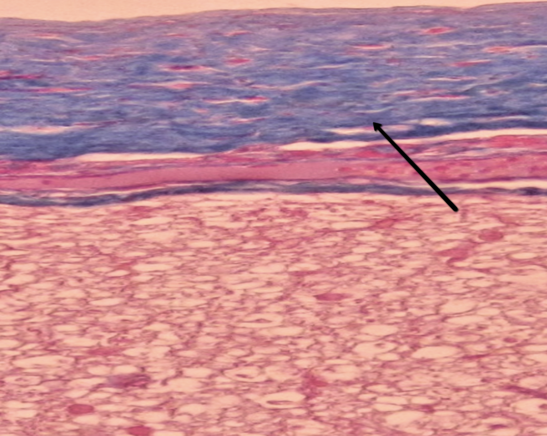 <p><span>Identify the thick dark structure/layer indicated by the pointer.</span></p>