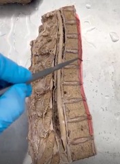 <p>Name the ligament</p>