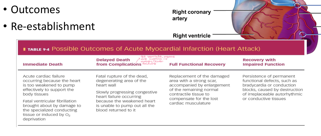 <ul><li><p>Blockage of a coronary artery is referred to as a Myocardial Infarct (MI)</p></li><li><p>Outcomes</p></li><li><p>Re-establishment</p></li></ul><p></p>