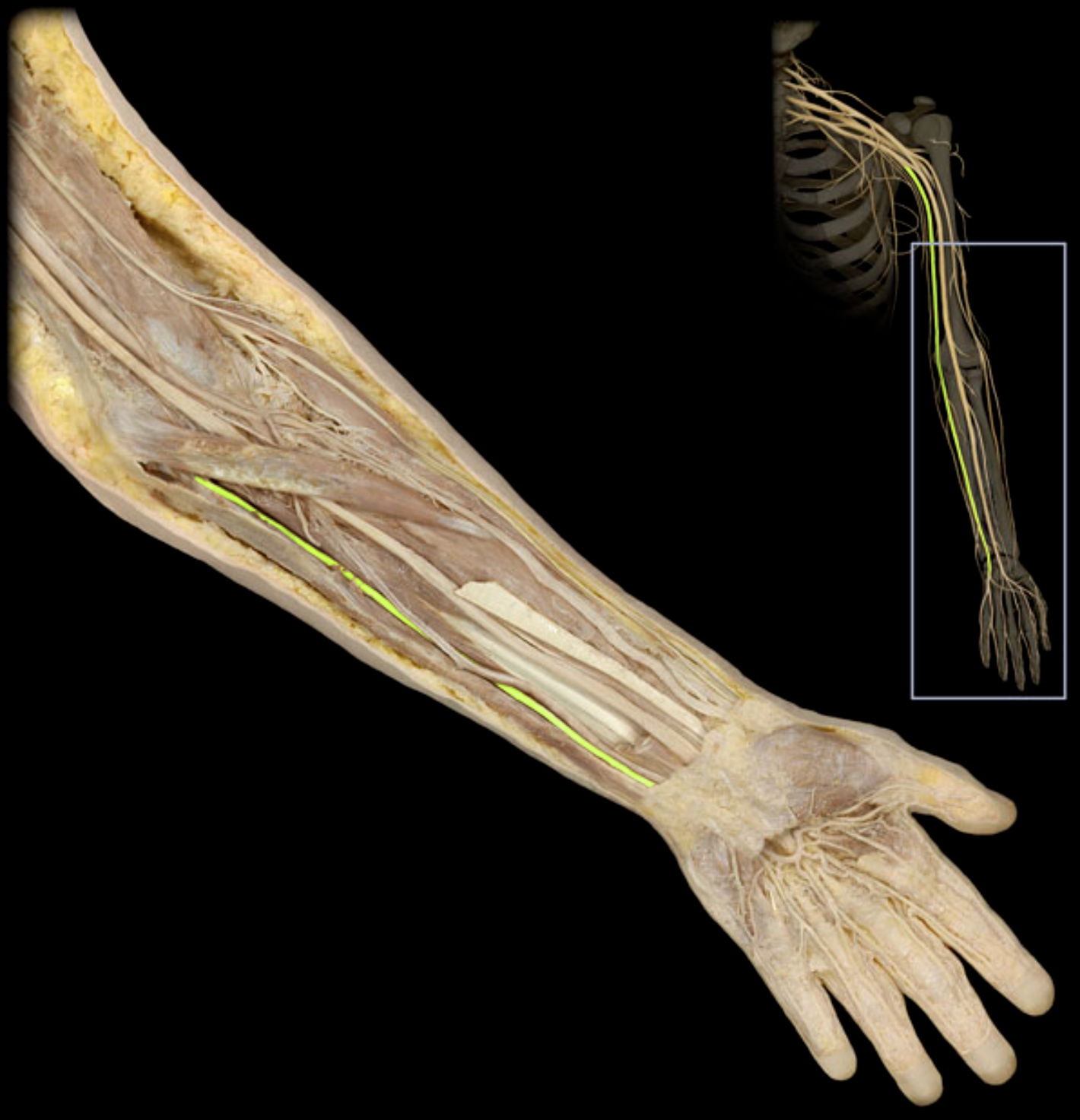 <p>What nerve is highlighted in yellow?</p>