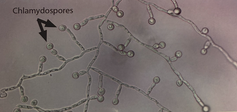 <p>“terminal chlamydospores” in cornmeal </p>
