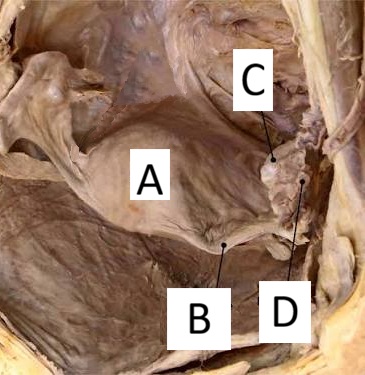 <p>A</p>