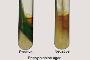 <ul><li><p><strong>Purpose: </strong>To determine whether bacteria produce phenylalanine deaminase (enzyme). This allows it to remove the amino group from the amino acid phenylalanine to produce phenylpyruvic acid (PPA) and ammonia</p></li><li><p><strong>Content: </strong>Amino acid phenylalanine</p></li><li><p><strong>Detection Method: </strong>PPA (phenylpyruvic acid) can be detected by ferric chloride. The ferric ion reacts with PPA to produce a green color</p></li><li><p><strong>Original test color/physical appearance: </strong>Solid agar slant that is transparent and straw-colored/light yellow</p></li><li><p><strong>Positive result appearance: </strong>Slant color changes from yellow to green</p></li><li><p><strong>Positive result interpretation: </strong>Phenylalanine deaminase was produced, allowing it to deaminate phenylalanine into phenylpyruvic acid. This acid reacted with the added reagent to form a green-colored complex</p></li><li><p><strong>Negative result appearance: </strong>Slant color stays yellow</p></li><li><p><strong>Negative result interpretation: </strong>Phenylalanine deaminase was not produced, so no phenylpyruvic acid was formed to react with the reagent</p></li><li><p><strong>Reagents: </strong>Add<strong> </strong>4-5 drops of 10% Ferric Chloride (FeCl<sub>3</sub>) to the slant after incubation</p></li></ul><p></p>
