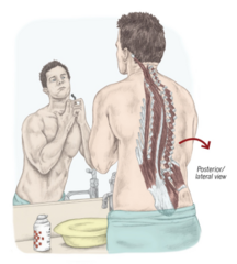<p>erector spinae</p><p>standing at the sink to complete self-care activities</p>