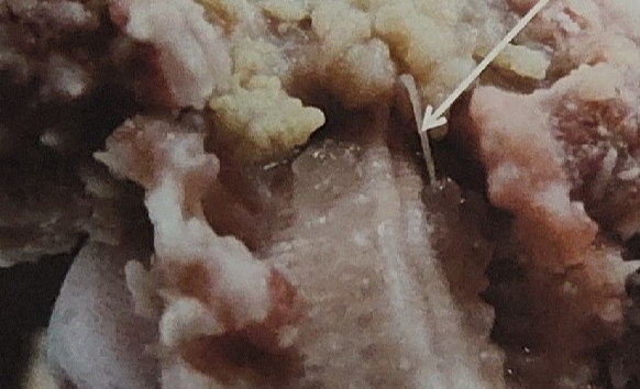 <p>what is this on the sea star</p>