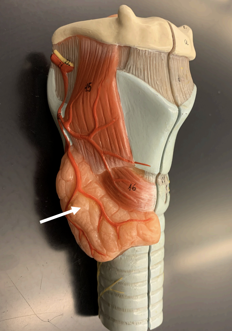 <p>this gland produces T3, T4, and calcitonin to control the body’s metabolic rate</p>