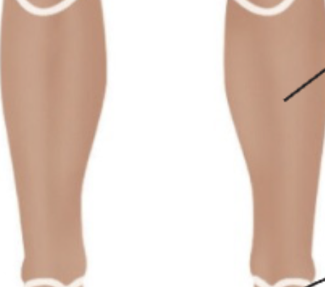 <p>Front of lower leg. </p>