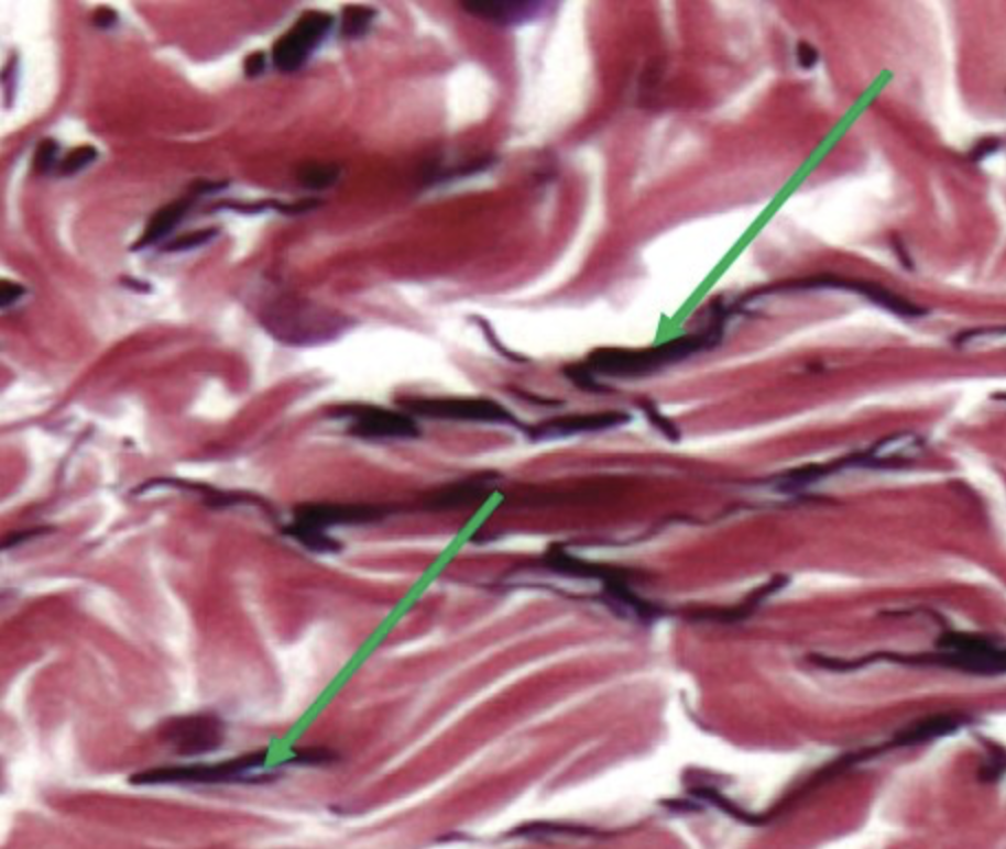 <p>identify the structure indicated by the pointer</p>
