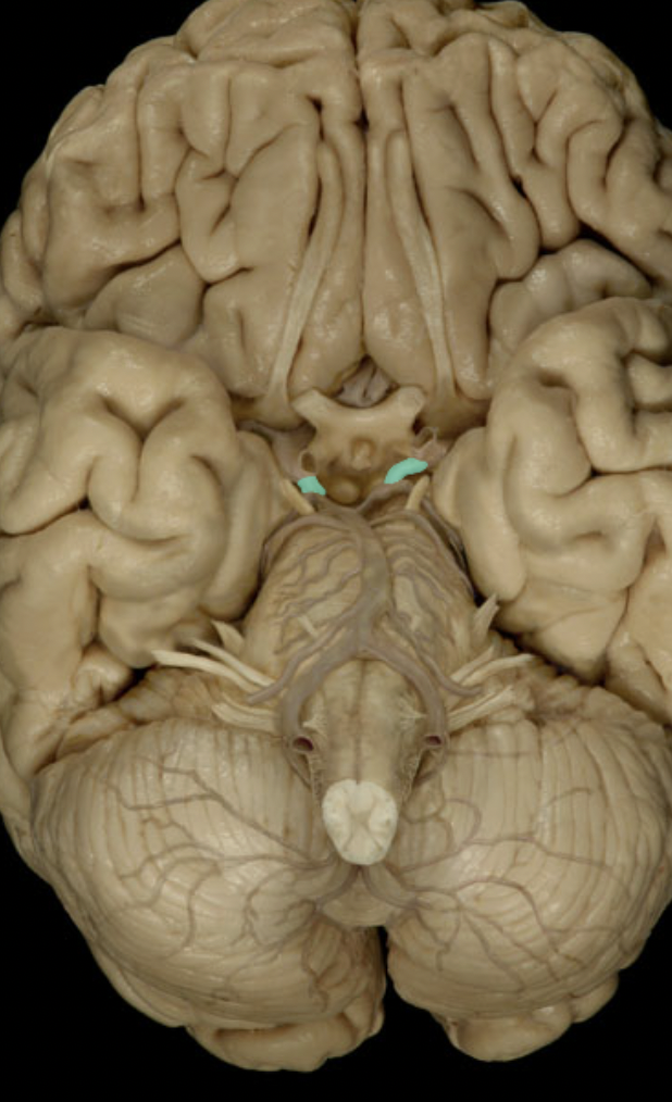 <p>Identify the artery to the brain (circle of willis)</p>