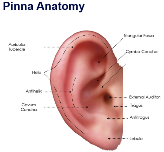 <p>label missing part</p>