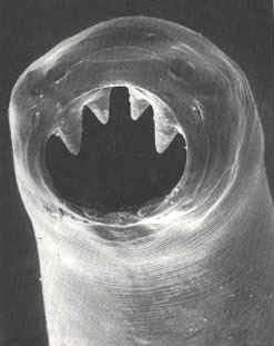 <p>Old world hookworm? Cutting teeth (4 teeth pointy)</p><p>Route of infection = wound/lesion of skin → blood → lungs → small bowel</p>