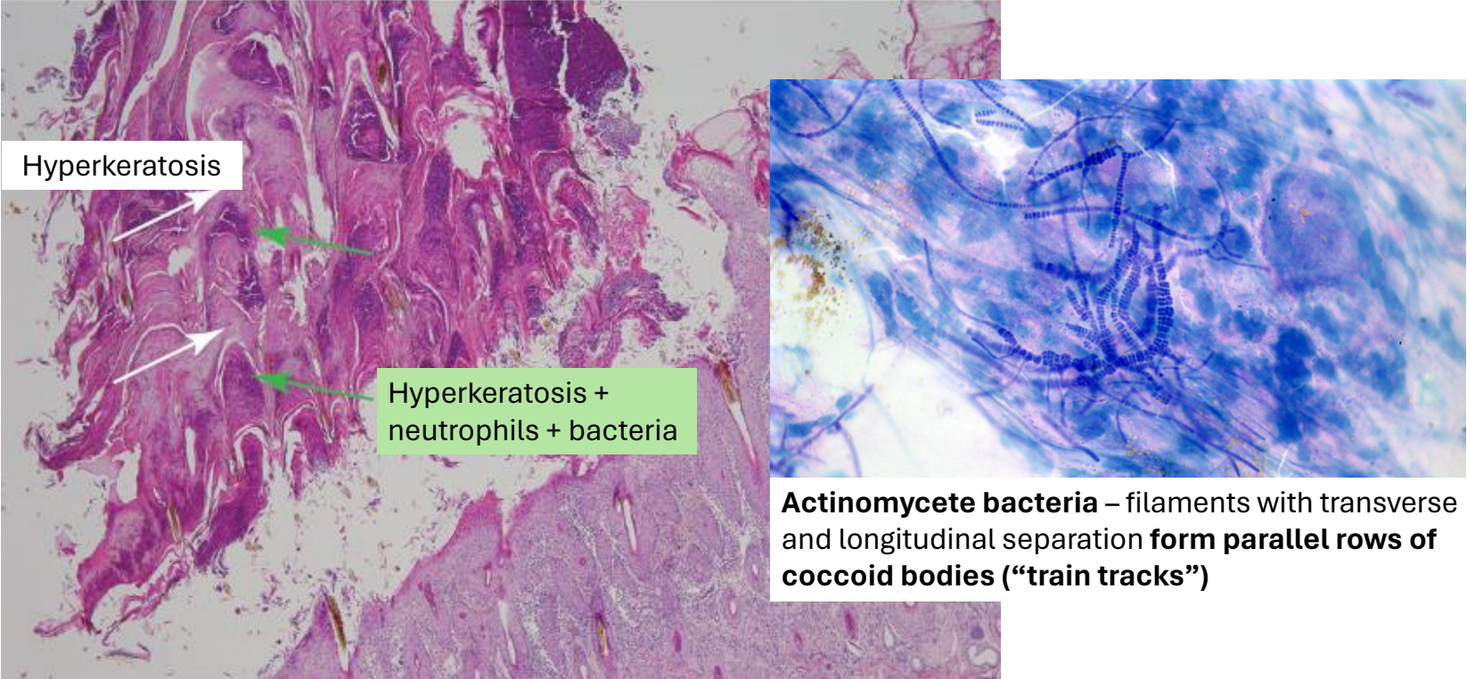 <p><strong>trauma to the skin</strong> &amp; prolonged <strong>wetting</strong> → zoospores enter via breaks in the skin surface → invasion with neutrophils → epidermal regeneration → cycle starts again → <strong>thick laminar &amp; parakeratotic crusts = characteristic</strong></p>