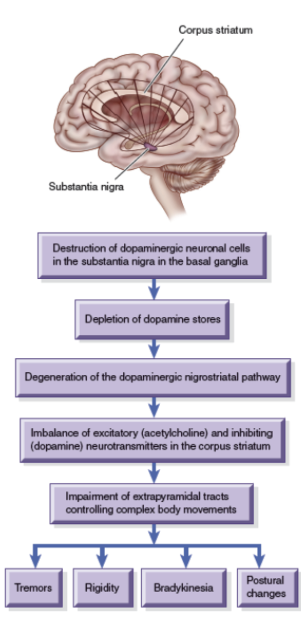<ul><li><p>Slow, progressive neurologic movement disorder associated with <mark data-color="purple" style="background-color: purple; color: inherit;">decreased levels of dopamine</mark></p></li><li><p>Manifestations:</p><ul><li><p>Cardinal: tremor, rigidity, bradykinesia/akinesia →pill rolling, postural instability</p></li><li><p>Autonomic: sweating, drooling, flushing, orthostatic hypotension, gastric and urinary retention</p></li><li><p>Dysphagia</p></li><li><p>Psychiatric changes: depression, anxiety, dementia, delirium, hallucinations</p></li></ul></li></ul><p></p>