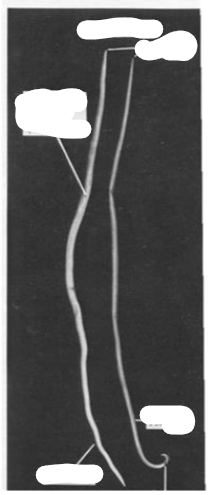 <p>What are these parasites </p>