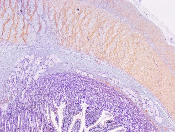 <p>Đoạn nào của ống tiêu hoá ?</p>