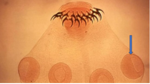 <p>2) What are the circular structures surrounding the scolex?</p>