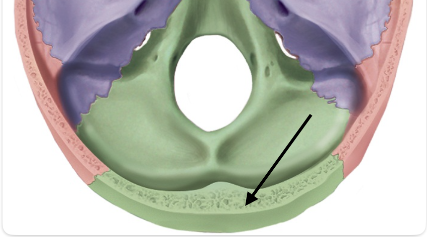 <p>Identify the bone of the skull.</p>