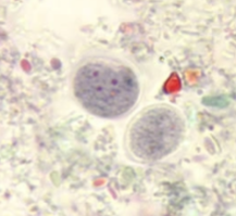 <p>4 nuclei with karyosome</p><p>6-10 microbs</p>