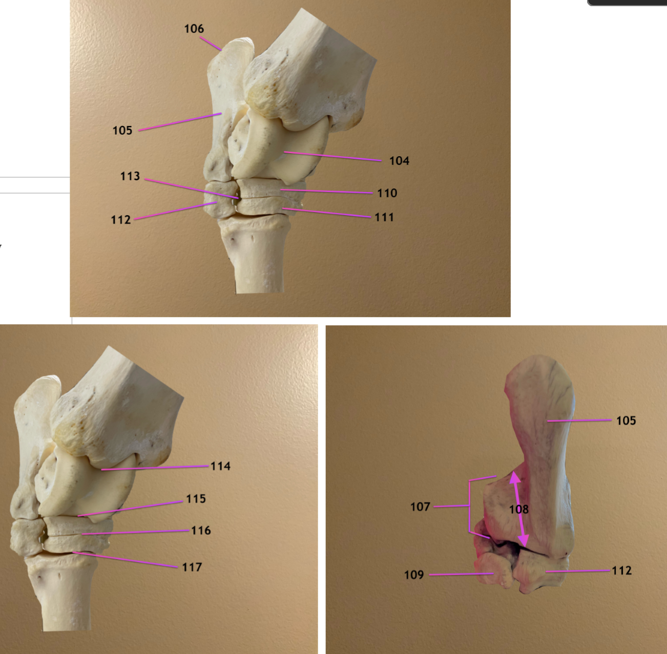 <p>pic 1/2: craniolateral view of tarsus</p><p>pic 3: caudal view of tarsus</p><p>.</p><p>label 104-107</p>