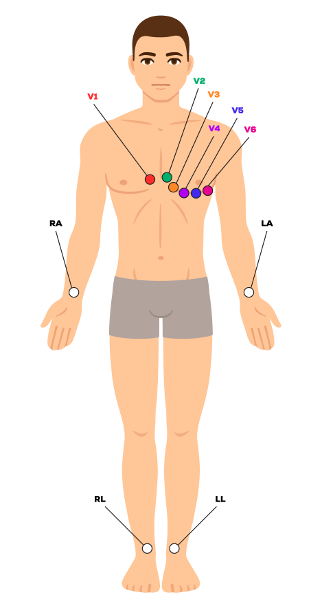 <p>12 leads</p>
