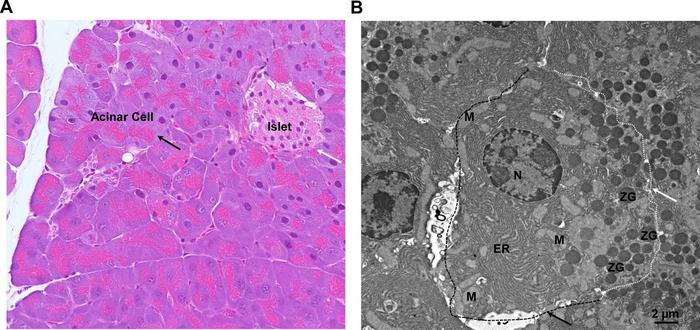 <p>Exocrine cells in pancreas</p>