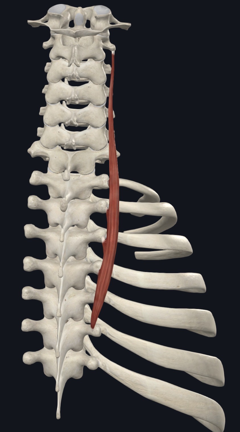 <p>Longissimus Cervicis <strong>Insertion</strong></p>