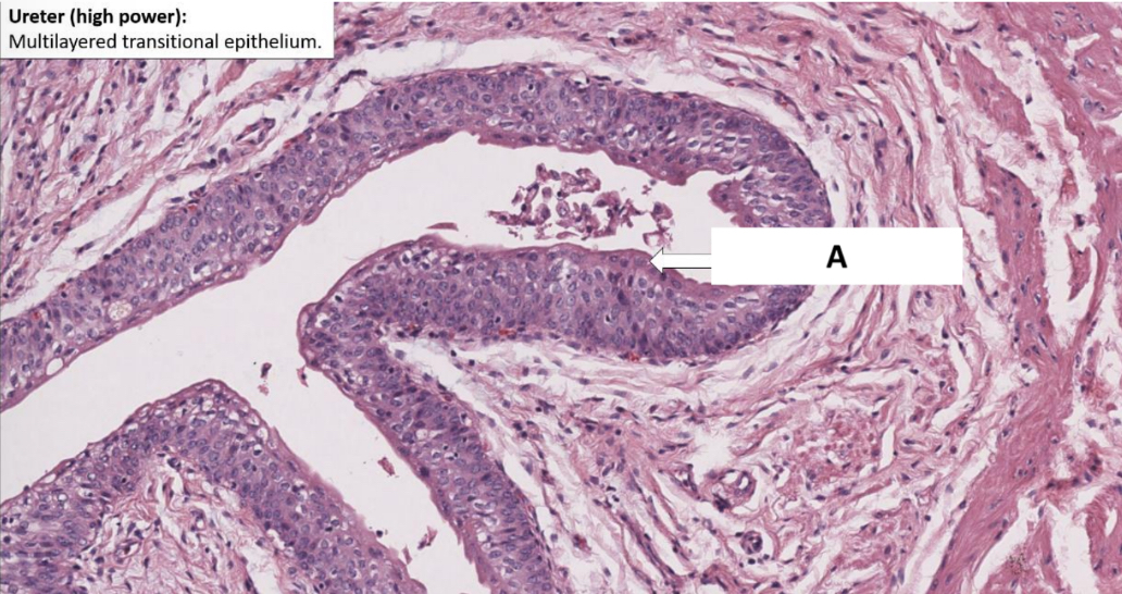 <p>Name the structure indicated by A.</p>