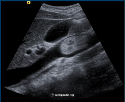 <p>what is seen in this image?</p>