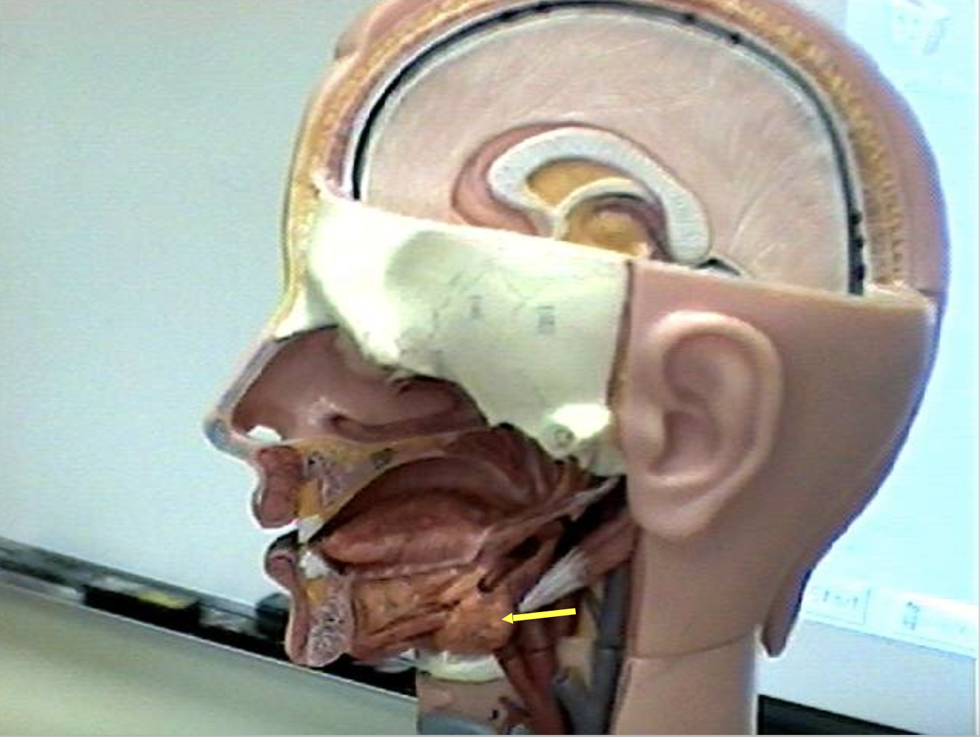 <p>Identify the organs of the digestive tract.</p>