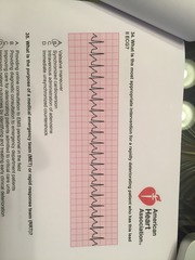 <p>Synchronized cardioversion</p>