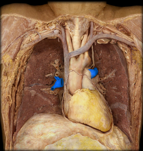 <p>Pulmonary a.</p>