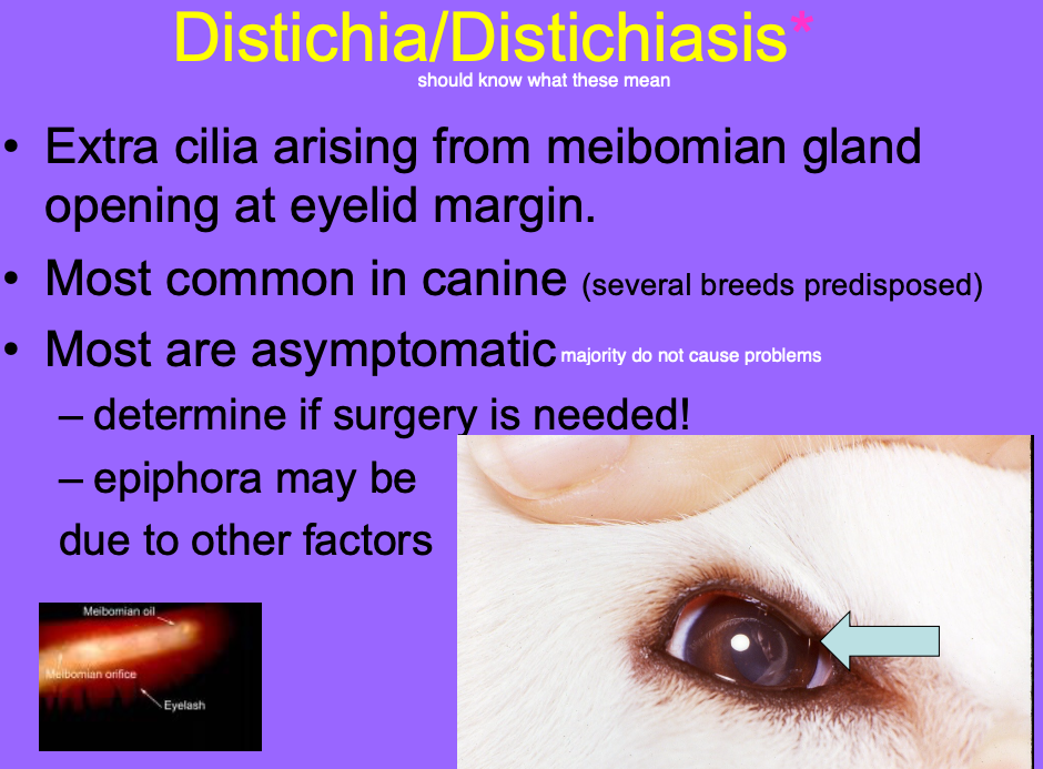 <p>extra cilia growing out of the meibomian gland opening at the eyelid margin.</p>
