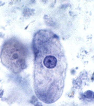 <ul><li><p>causes amebiasis </p></li></ul><p></p>