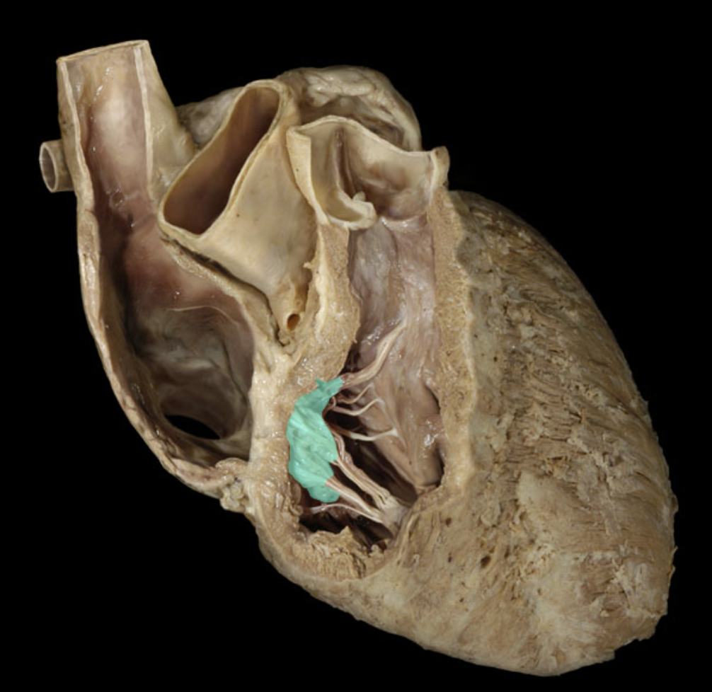<p>Identify the feature of the right atrium</p>