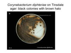 <p>Tindale agar</p>