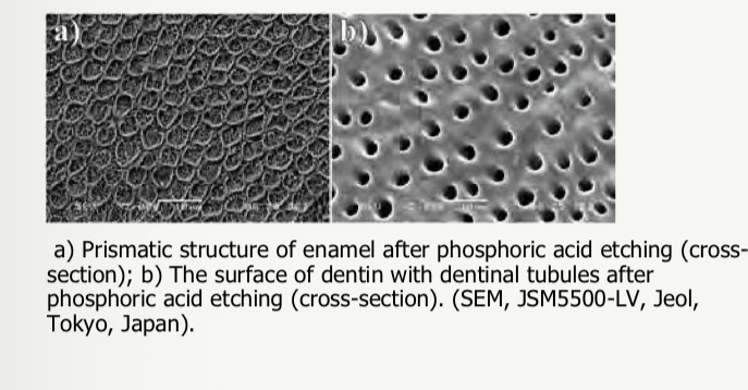 <p>Structure- <span>contains a lot of fluids</span></p><p><span>50% inorganic content</span></p><p><span>30% organic</span></p><p><span>20% fluid- must stay moist </span></p><p><span>Hybrid layer formed </span></p><p><span>Vs in enamel </span></p><p><span>96% inorganic</span></p><p><span>Dry bonding surface</span></p><p><span>Micro mechanical retention </span></p>
