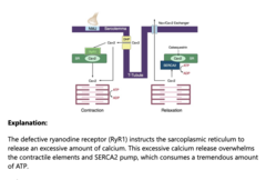 <p>RYR1</p>