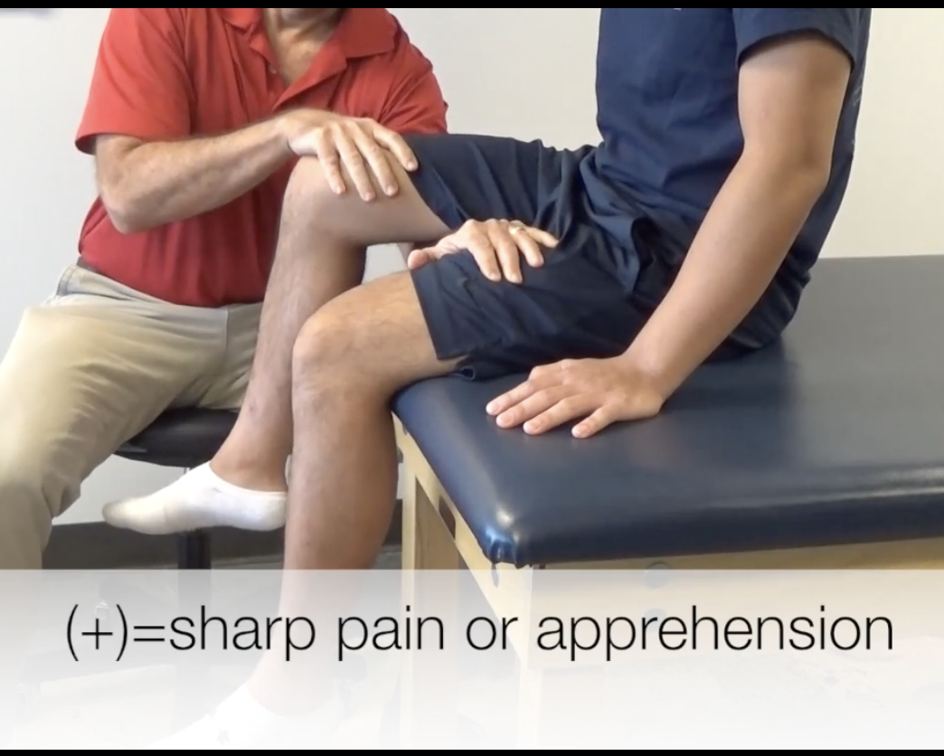 <p><strong>Purpose:</strong> <span style="color: red;"><strong>Femoral shaft stress fracture</strong></span></p><p><br><strong>How to Perform:</strong></p><ol><li><p>Pt seated edge of table with legs hanging</p></li><li><p>Examiner places their forearm under mid-thigh as fulcrum with hand on contralateral thigh</p></li><li><p>With the opposite hand, apply gentle but firm downward pressure superior to anterior knee (distal femur)</p></li></ol><p><br><strong>Positive Test: </strong></p><ul><li><p><span style="color: red;"><strong>Sharp, localized anterior thigh/groin pain</strong></span></p></li><li><p><span style="color: red;"><strong>Apprehension/pain </strong></span><span style="color: red;"><strong>when the fulcrum arm passes under the fracture site</strong></span></p></li></ul><p></p>