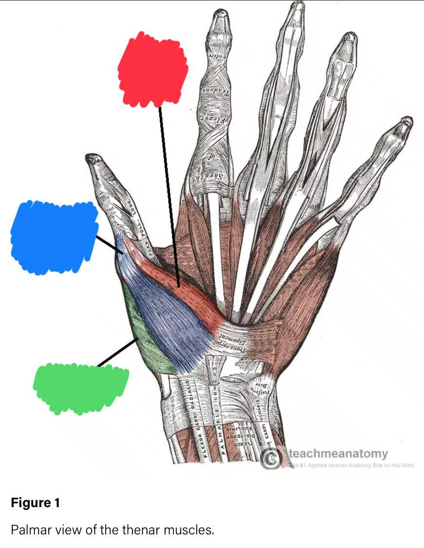 <p>What is the muscle in red?</p>