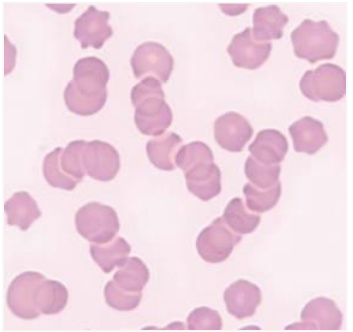 <p>Equine erythrocytes form rouleaux easily; even in healthy horses</p>