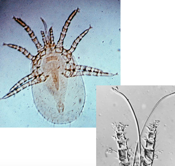 <p>Red roost mite of poultry “vampire feeding model”</p>
