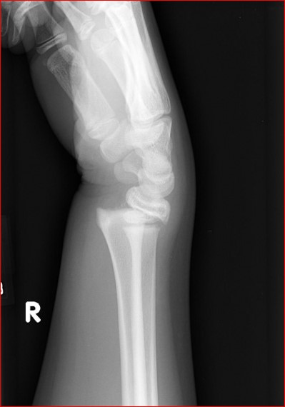 <p>What is the diagnosis?</p>