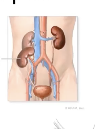 <ul><li><p> transplanted kidney is not placed in the same location as native kidney</p></li></ul><p></p>