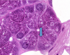 <p>What is a cytoplasmic structure that usually stains eosinophilically?</p>