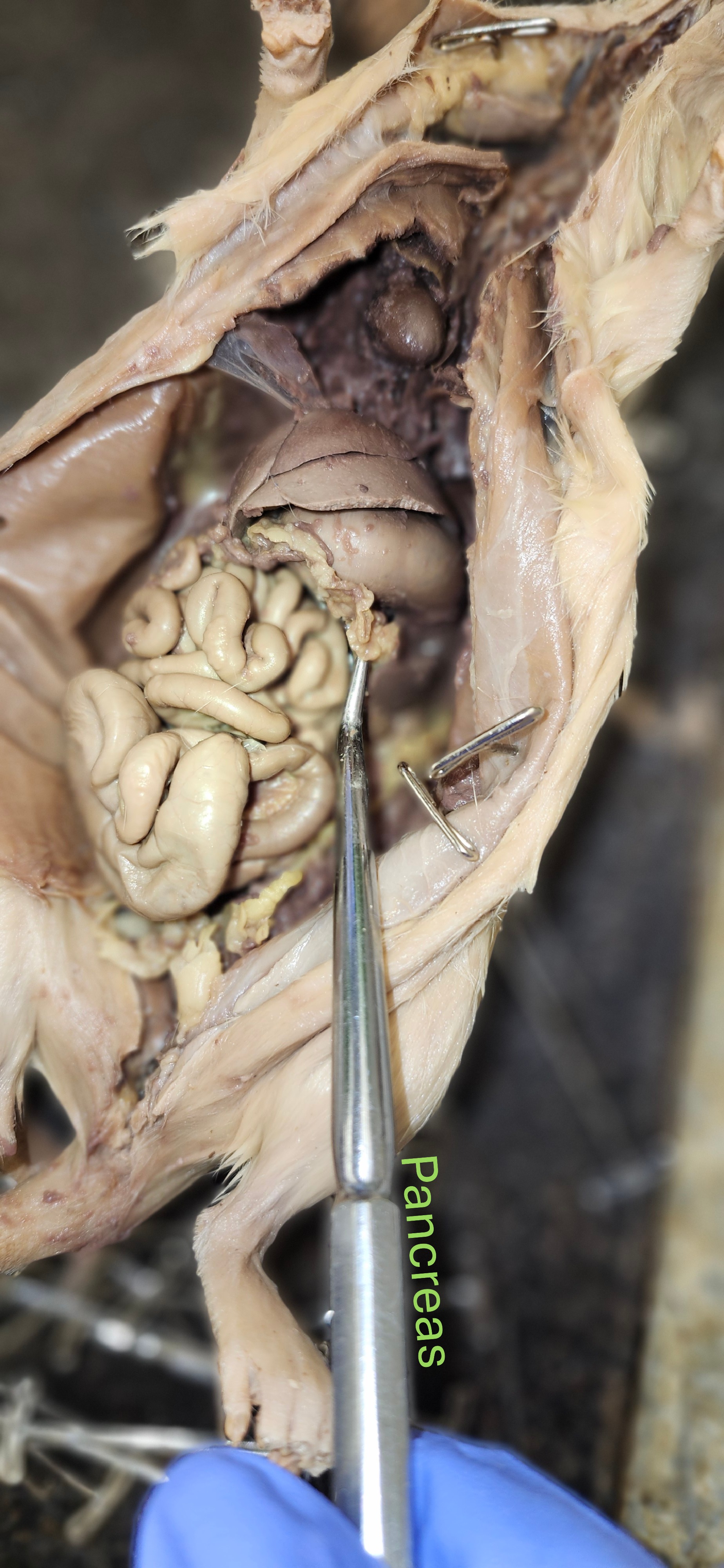<p><span style="color: rgb(255, 255, 255);">pancreas</span></p>