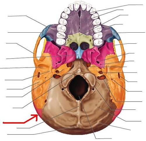 term image