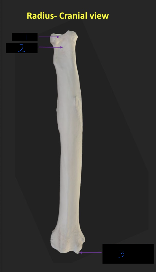 <p>Name these parts of the radius</p>