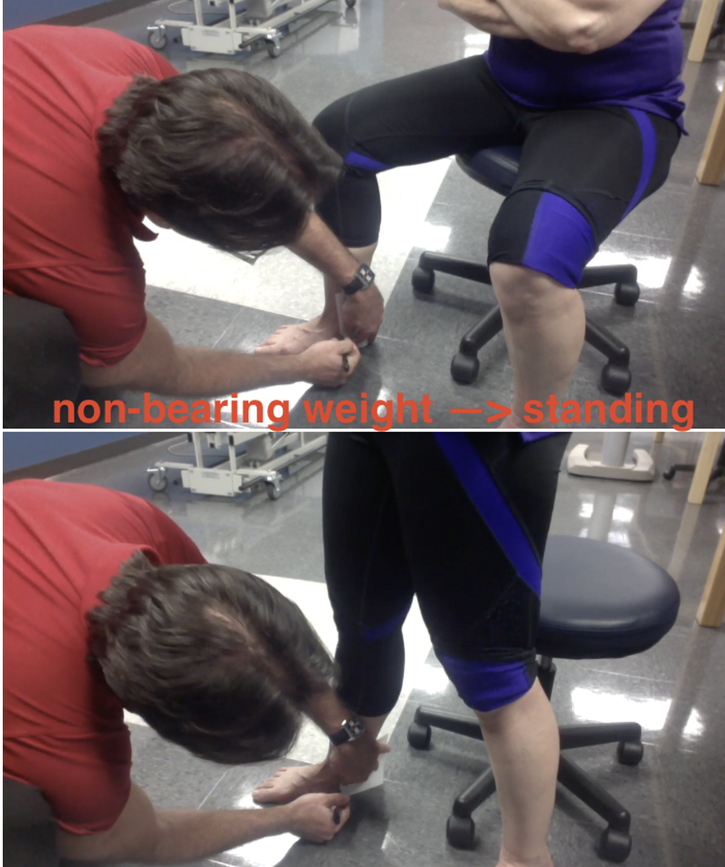 <p><strong>Purpose</strong></p><ul><li><p><span style="color: red;"><strong>Excessive medial longitudinal arch collapse</strong></span></p></li><li><p><span style="color: red;"><strong>Abnormal pronation</strong></span></p></li></ul><p></p><p><strong>How to Perform</strong></p><ol><li><p>Pt seated</p></li><li><p>Place subtalar joint in neutral</p></li><li><p>Palpate and mark the navicular tubercle height from the floor using an index card</p></li><li><p>Have pt stand</p></li><li><p>Repeat measurement and calculate the difference</p></li></ol><p></p><p><strong>Positive Test</strong></p><ul><li><p><span style="color: red;"><strong>Navicular drop >10 mm</strong></span></p></li></ul><p></p>